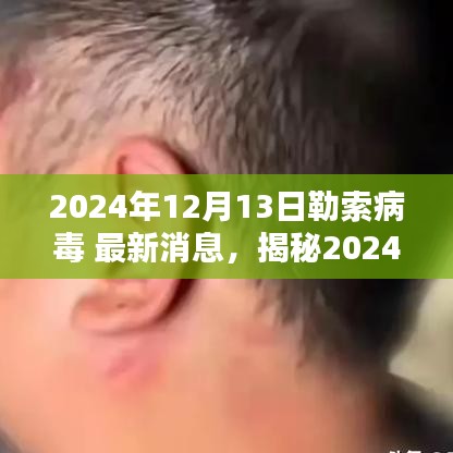 揭秘，2024年勒索病毒最新动态与应对策略深度解析发布最新消息