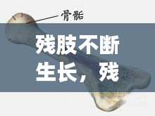 残肢不断生长，残肢外形,以什么形状最佳 