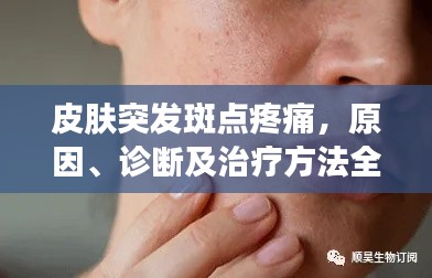 皮肤突发斑点疼痛，原因、诊断及治疗方法全解析